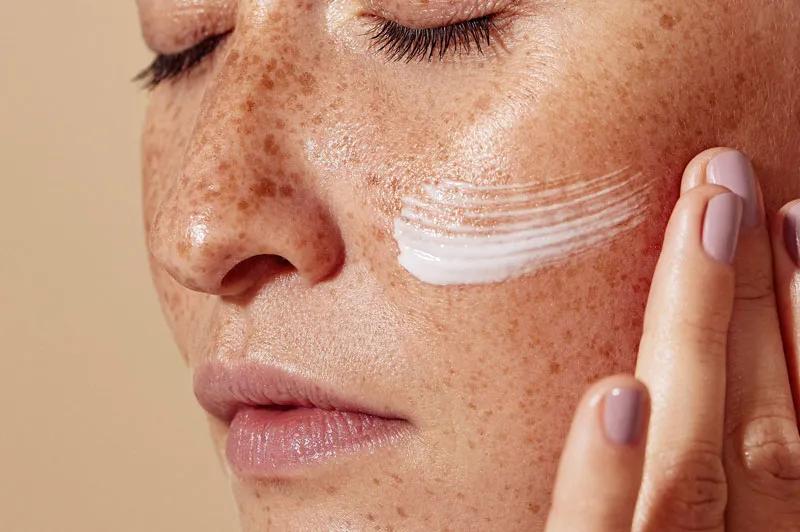 How Do Dermatologists Approach Pigmentation Treatment?